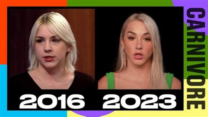 Mikhaila Peterson Nose Job Before And After Photos Model Fact